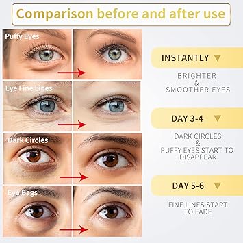 Eye Care